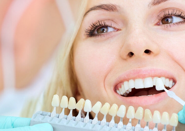 protezuvannya-zubiv_1