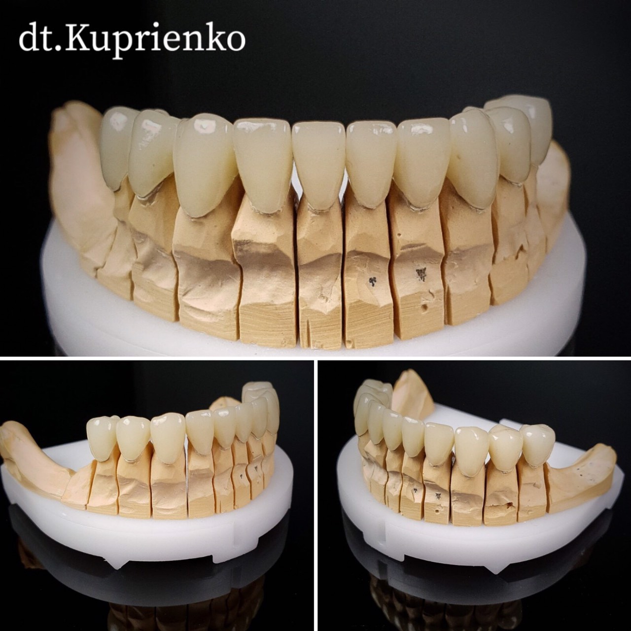 czyrkoniyevi-koronky_1