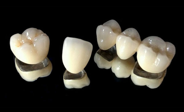 mostopodibni-zubni-protezy_1