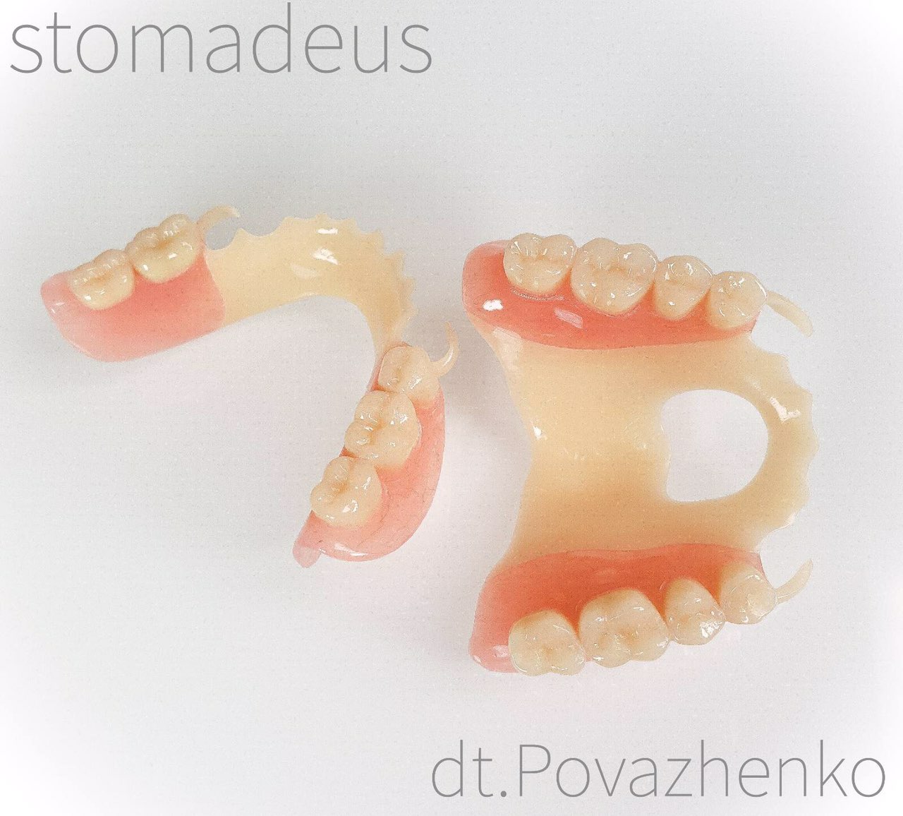 znimni-zubni-protezy_1