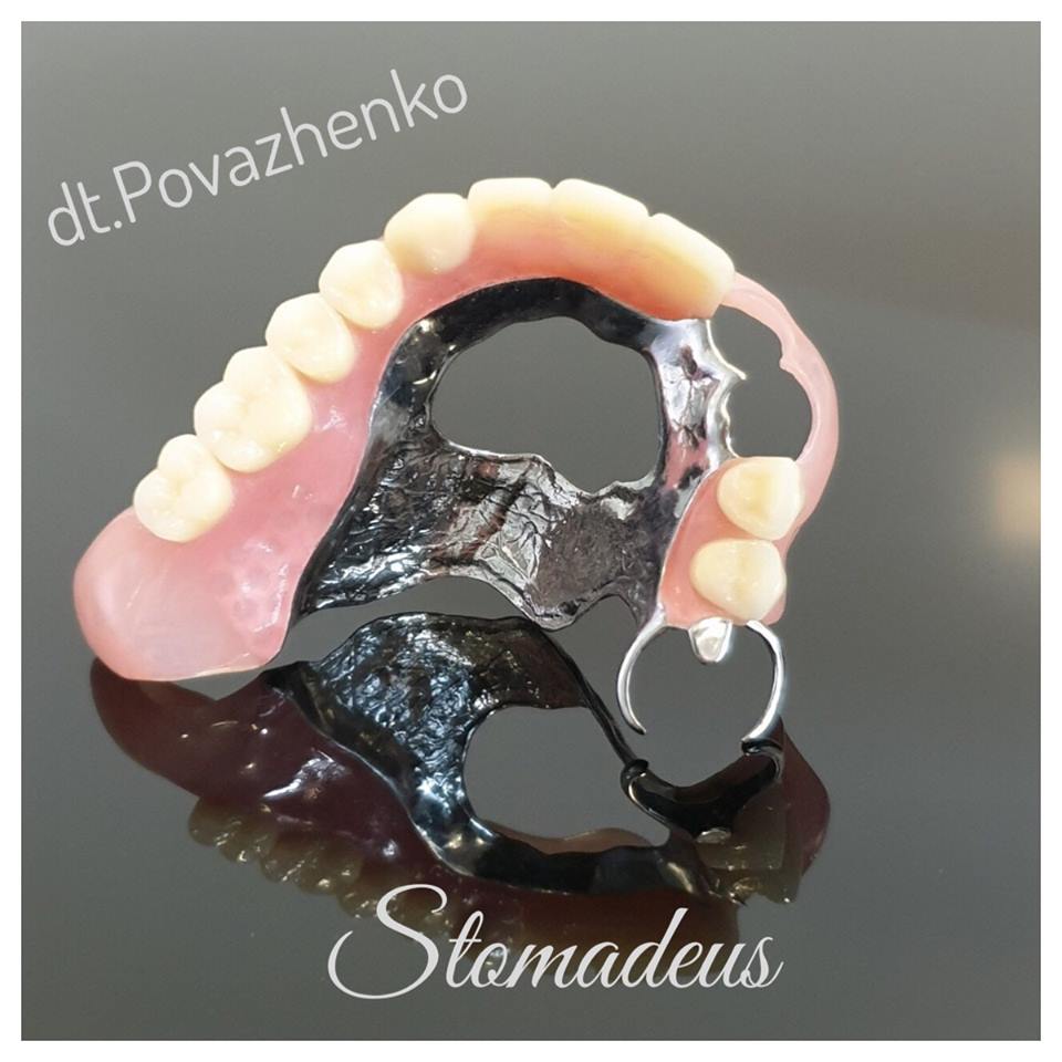 znimni-zubni-protezy_2