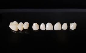 keramichni-koronky_4