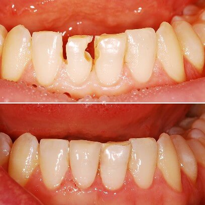 estetychna-restavracziya_1