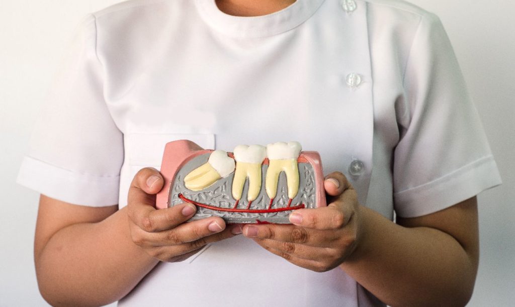 vydalennya-retynovanyh-zubiv_1