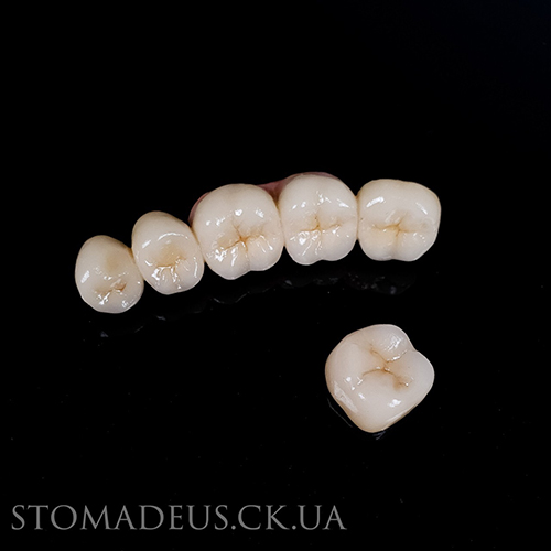 mostopodibni-zubni-protezy_2