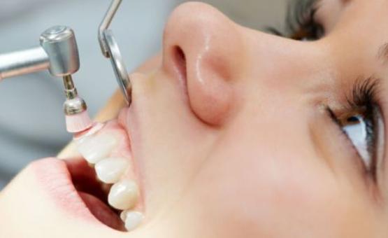 ultrazvukova-chystka-zubiv_2