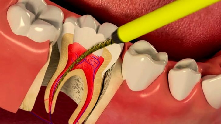 vartist-endodontiyi_1